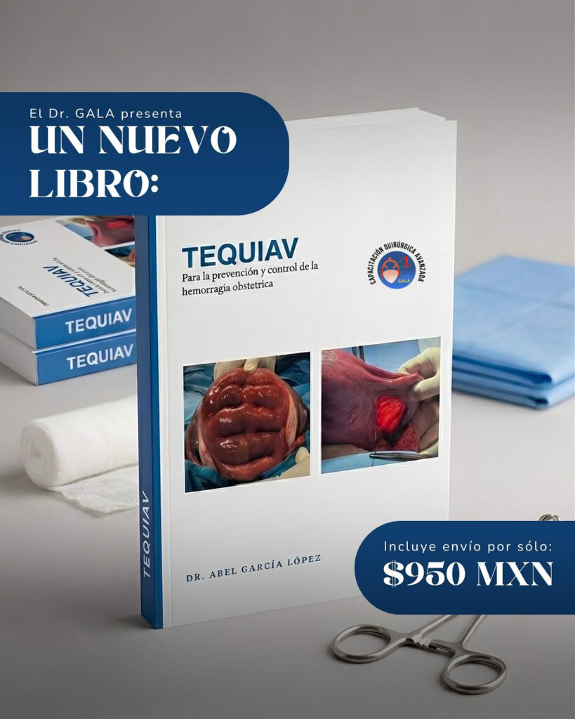 Tequiav